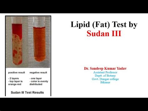 Sudan III test for lipids .